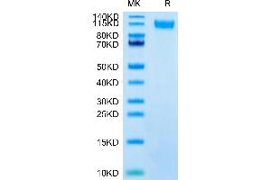 SARS-CoV-2 Spike S1 (Lambda C. (SARS-CoV-2 Spike S1 Protein (C.37 - Lambda) (His tag))