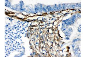 Caldesmon was detected in paraffin-embedded sections of human intestinal tissues using rabbit anti- Caldesmon Antigen Affinity purified polyclonal antibody (Catalog # ) at 1 ? (Caldesmon antibody  (AA 1-120))
