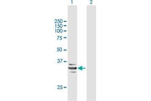 Western Blot analysis of RARRES1 expression in transfected 293T cell line by RARRES1 MaxPab polyclonal antibody. (RARRES1 antibody  (AA 1-294))