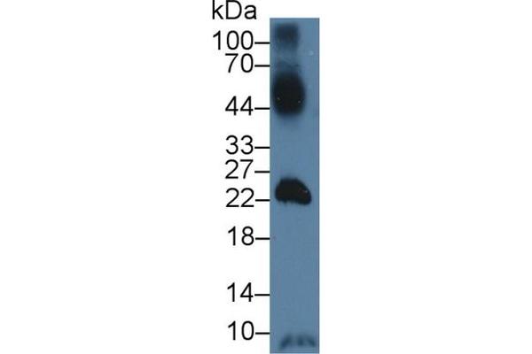 SLC2A14 Antikörper  (AA 1-105)