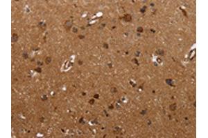 The image on the left is immunohistochemistry of paraffin-embedded Human brain tissue using ABIN7190664(FMN2 Antibody) at dilution 1/30, on the right is treated with synthetic peptide. (Formin 2 antibody)