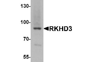 Western blot analysis of RKHD3 in mouse skeletal muscle tissue lysate with RKHD3 antibody at 1 µg/mL. (MEX3B antibody  (Middle Region))
