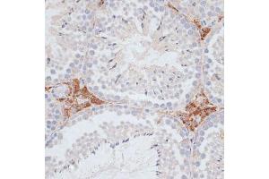 Immunohistochemistry of paraffin-embedded mouse testis using KIFC1 antibody (ABIN1680592, ABIN3017666, ABIN3017667 and ABIN6220203) at dilution of 1:100 (40x lens).