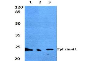 Western blot (WB) analyzes of Ephrin-A1 antibody at 1/500 dilution.