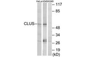 Western blot analysis of extracts from HeLa cells/A549 cells, using CLUS Antibody. (Clusterin antibody  (AA 400-449))
