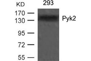 Image no. 3 for anti-PTK2B Protein tyrosine Kinase 2 beta (PTK2B) (Tyr402) antibody (ABIN197440) (PTK2B antibody  (Tyr402))
