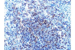 Immunohistochemistry (IHC) image for anti-CD79b Molecule, Immunoglobulin-Associated beta (CD79B) antibody (ABIN1682474)