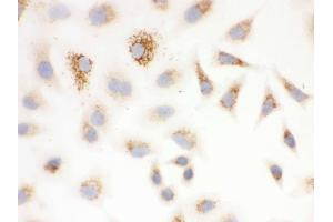 IHC analysis of SOD2  using anti-SOD2  antibody . (SOD2 antibody  (C-Term))