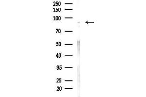 anti-PHD Finger Protein 17 (PHF17) (C-Term) antibody