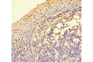 Immunohistochemistry of paraffin-embedded human tonsil tissue using ABIN7156438 at dilution of 1:100 (ITGA4 antibody  (AA 376-558))