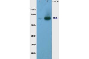 L1 human rectal carcinoma lysates L2 human gastric carcinoma lysates, probed with Anti Phospho-Torc2/Crtc2(Ser171) Polyclonal Antibody, Unconjugated (ABIN745988) at 1:200 overnight at 4 °C. (CRTC2 antibody  (pSer171))