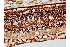 CRB1 antibody  (AA 20-200)