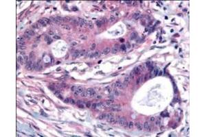 Immunohistochemistry (IHC) image for anti-Polo-Like Kinase 1 (PLK1) (pThr210) antibody (ABIN129581)