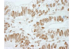 Immunohistochemistry (IHC) image for anti-Retinoblastoma Binding Protein 5 (RBBP5) (C-Term) antibody (ABIN7448757) (RBBP5 antibody  (C-Term))