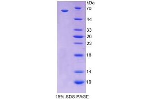 SDS-PAGE (SDS) image for Caudal Type Homeobox 2 (CDX2) (AA 1-313) protein (His tag,GST tag) (ABIN6237787)