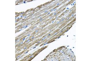 Immunohistochemistry of paraffin-embedded mouse heart using UBE2F Rabbit pAb  at dilution of 1:200 (40x lens). (UBE2F antibody  (AA 1-185))