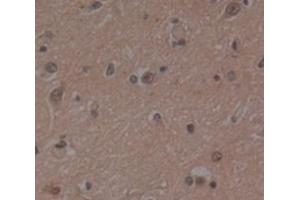 Used in DAB staining on fromalin fixed paraffin- embedded Kidney tissue (PSMD4/ASF antibody  (AA 1-377))