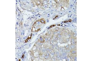 Immunohistochemistry (IHC) image for anti-Complement Factor H (CFH) (AA 20-270) antibody (ABIN3023097)