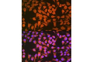 Immunofluorescence analysis of HeLa cells using CBS Rabbit mAb (ABIN7266615) at dilution of 1:100 (40x lens). (CBS antibody)
