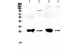 Western blot analysis of GSTT1 using anti-GSTT1 antibody . (GSTT1 antibody  (AA 3-231))