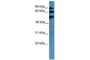 WB Suggested Anti-BBS2 Antibody Titration: 0.