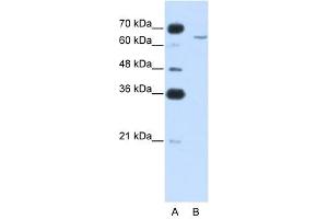 CPEB2 antibody used at 0. (CPEB2 antibody  (N-Term))