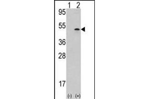 Western blot analysis of AURKB (arrow) using rabbit polyclonal Aurora-B (ARK/STK12) Antibody (Center) (ABIN391354 and ABIN2841375). (Aurora-B (ARK/STK12) (AA 283-313) antibody)