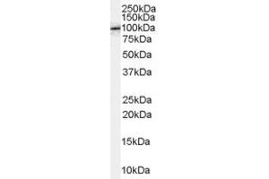 Western Blotting (WB) image for anti-Amyloid beta (A4) Precursor Protein-Binding, Family B, Member 1 (Fe65) (APBB1) (C-Term) antibody (ABIN2465409) (FE65 antibody  (C-Term))