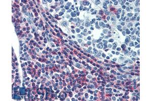 Immunohistochemistry staining of human tonsil (paraffin sections) using anti-CD50 (MEM-04). (ICAM-3/CD50 antibody)