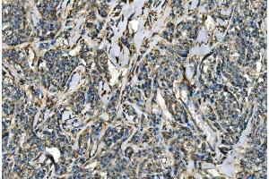 IHC analysis of CX3CR1 using anti-CX3CR1 antibody (ABIN7599293).