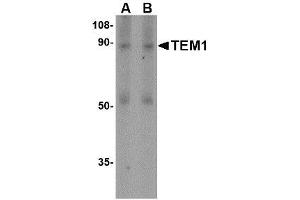 Image no. 1 for anti-CD248 Molecule, Endosialin (CD248) (N-Term) antibody (ABIN1494342)