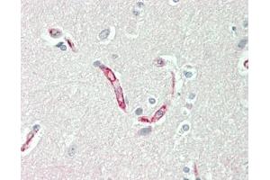 Human Brain, Cortex: Formalin-Fixed, Paraffin-Embedded (FFPE) (CD147 antibody)