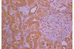 Paraffin embedded rat kidney section post 30% blood volume loss and treatment with ketoprofen was stained with anti-IL-1 followed by Rabbit Anti-Goat IgG(H+L)-BIOT, HRP conjugated streptavidin, DAB, and hematoxylin. (Rabbit anti-Goat IgG (Heavy & Light Chain) Antibody (Biotin))