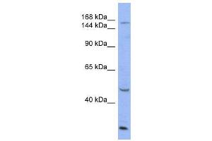 Western Blotting (WB) image for anti-ATPase, Cu++ Transporting, alpha Polypeptide (ATP7A) (Middle Region) antibody (ABIN2778126)