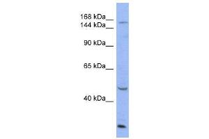 WB Suggested Anti-ATP7A  Antibody Titration: 0. (ATP7A antibody  (Middle Region))