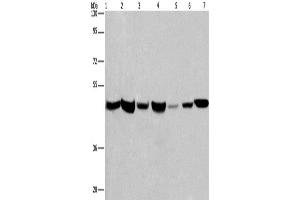 Western Blotting (WB) image for anti-Adipocyte Plasma Membrane Associated Protein (APMAP) antibody (ABIN2431984) (APMAP antibody)