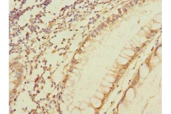 MPZL2 antibody  (AA 30-140)