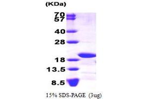 SDS-PAGE (SDS) image for NADH Dehydrogenase (Ubiquinone) Fe-S Protein 4, 18kDa (NADH-Coenzyme Q Reductase) (NDUFS4) (AA 43-175) protein (ABIN667110)