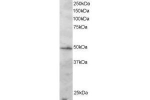 Western Blotting (WB) image for anti-Interferon Regulatory Factor 2 (IRF2) antibody (ABIN5869172) (IRF2 antibody)