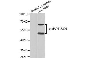 Western Blotting (WB) image for anti-Microtubule-Associated Protein tau (MAPT) (pSer396) antibody (ABIN1870397) (MAPT antibody  (pSer396))