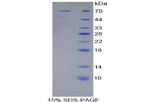 SDS-PAGE analysis of Human KIR2DL2 Protein. (KIR2DL2 Protein)