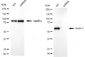 Western blotting analysis using beclin 1 antibody (ABIN7797760). (Recombinant Beclin 1 antibody)
