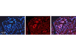 Rabbit Anti-CREB1 Antibody Catalog Number: ARP31264_T100 Formalin Fixed Paraffin Embedded Tissue: Human Testis Tissue Observed Staining: Nucleus Primary Antibody Concentration: 1:100 Other Working Concentrations: N/A Secondary Antibody: Donkey anti-Rabbit-Cy3 Secondary Antibody Concentration: 1:200 Magnification: 20X Exposure Time: 0. (CREB1 antibody  (N-Term))