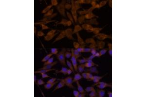 Immunofluorescence analysis of HeLa cells using UGT2B7 Polyclonal Antibody (ABIN6132908, ABIN6149903, ABIN6149904 and ABIN6218790) at dilution of 1:100 (40x lens). (UGT2B7 antibody  (AA 25-351))