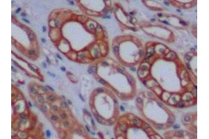 Immunohistochemistry (IHC) image for anti-Keratin 8 (KRT8) (AA 92-393) antibody (ABIN7434548)