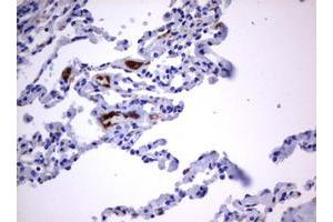 Image no. 2 for anti-Tumor Necrosis Factor Receptor Superfamily, Member 8 (TNFRSF8) (AA 19-379) antibody (ABIN1491085) (TNFRSF8 antibody  (AA 19-379))