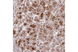 Immunohistochemical staining of human pancreas with FAM204A polyclonal antibody  shows strong cytoplasmic and nuclear positivity in exocrine glandular cells. (FAM204A antibody)
