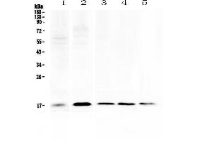 Western blot analysis of Psoriasin using anti-Psoriasin antibody . (S100A7 antibody  (AA 2-101))