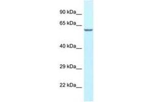 Image no. 1 for anti-Hyaluronan Binding Protein 2 (HABP2) (AA 338-387) antibody (ABIN6747676) (HABP2 antibody  (AA 338-387))