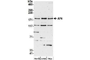anti-AF4/FMR2 Family, Member 1 (AFF1) (AA 1-50) antibody
